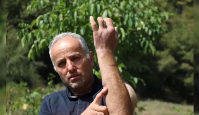 Babası gibi ayı saldırısına uğradı... Parmağı koptu...