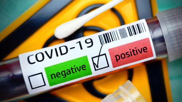Belediye başkanının KOVİD-19 testi pozitif çıktı...