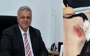 Oğlumun hayatını riske attılar…