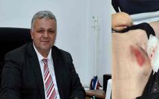 Oğlumun hayatını riske attılar…